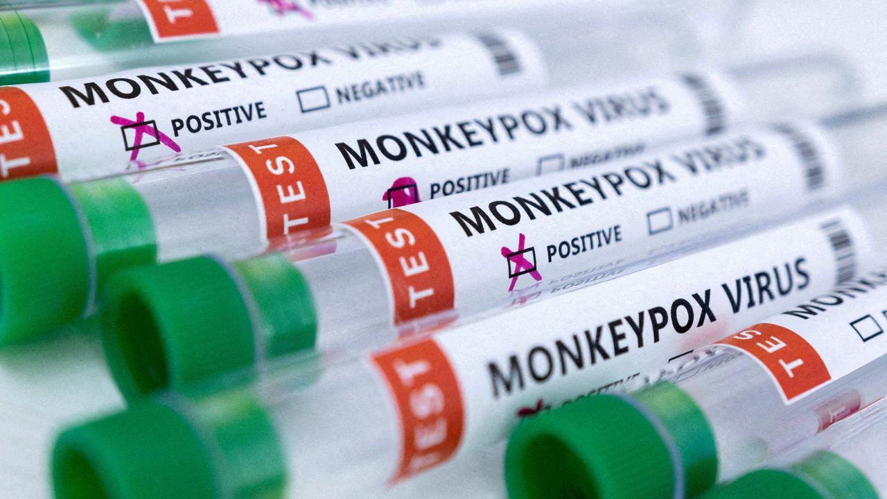 Monkeypox pode ter desencadeado problemas cardíacos em um paciente