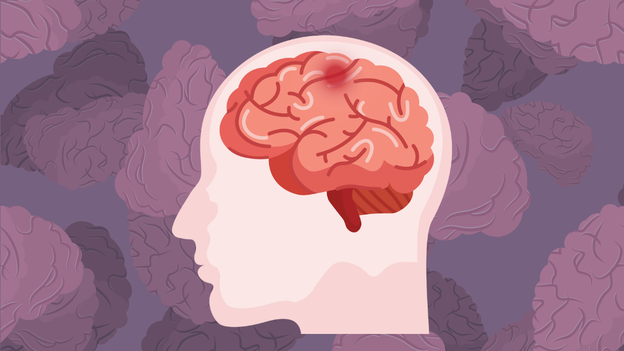 Día Mundial de la Parálisis Cerebral «Es la causa más frecuente de