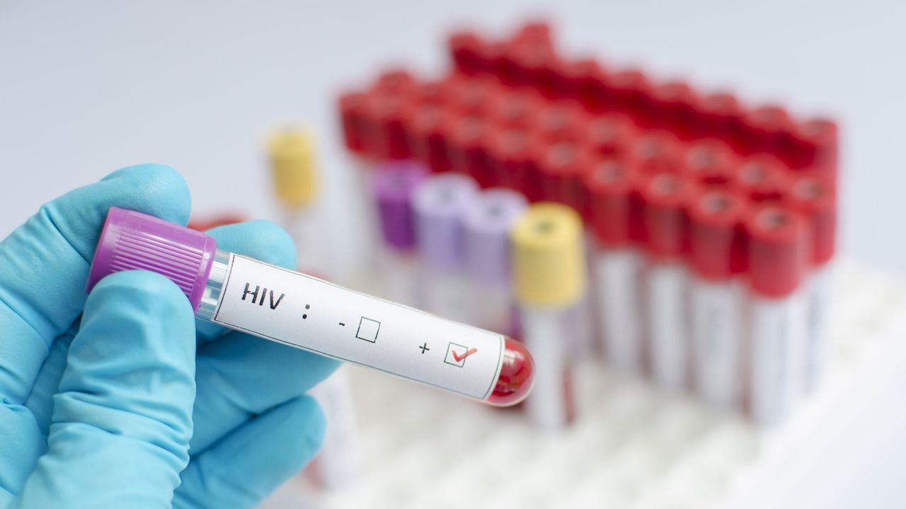 Avances científicos revelan nuevas estrategias en la lucha contra el VIH y el SIDA.